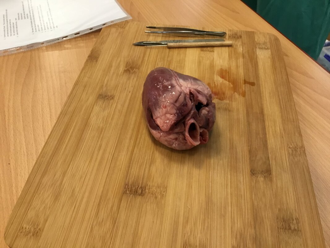 Image of Heart Dissection!